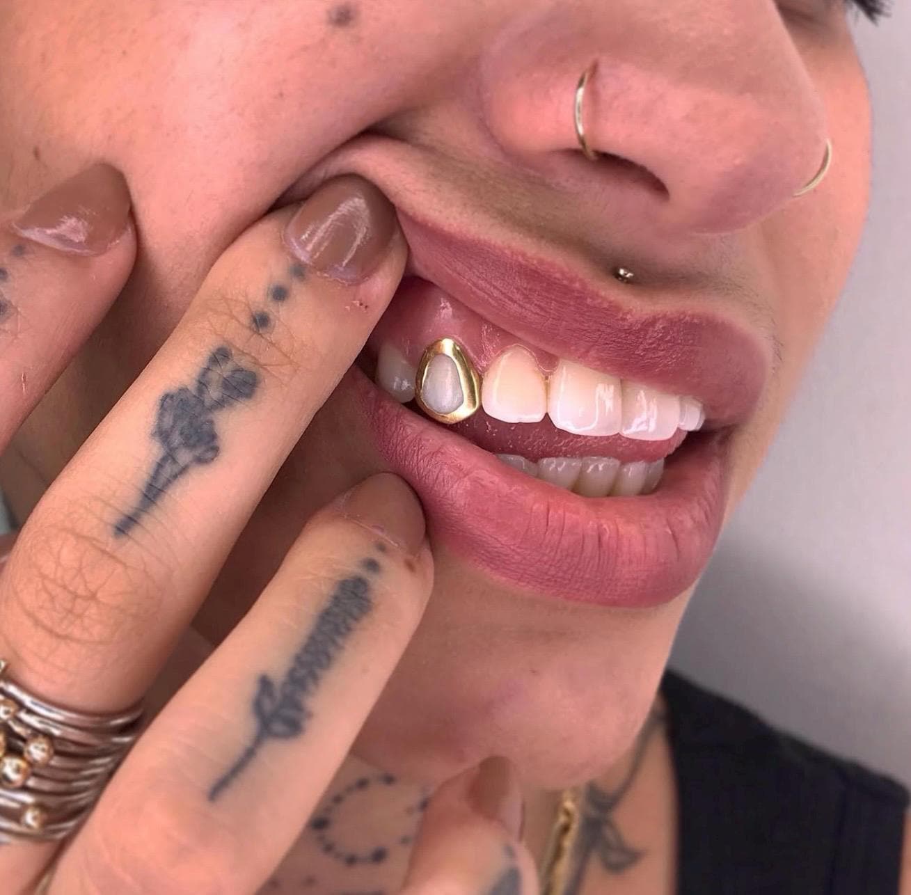 Open Face Window Cap — Handmade Custom Personalised Fit Grillz in Sterling Silver or Gold | Any Teeth! Free Mould Kit Included!
