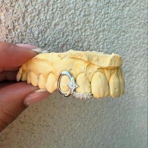 Open Face Window Star Iced Out Diamond Inlay — Handmade Custom Fit Grillz in Sterling Silver or Gold | Any Teeth! Free Mould Kit Included!