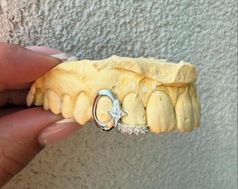 Iced Out Open Face Grillz: Custom Sterling Silver Diamond Inlay