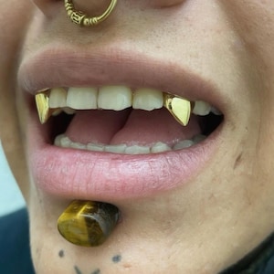 Vampire Fang K9’S Caps — Handmade Custom Personalised Fit Grillz in Sterling Silver or Gold | Any Teeth! Free Mould Kit Included!