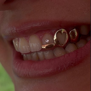 Open Face Heart Window, Single Cap, Inlay — Handmade Custom Fit Grillz in Sterling Silver or Gold | Any Teeth! Free Mould Kit Included!