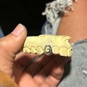 Spiral Window Cap Dental Gold & Silver Custom Made Grillz — Handmade Custom Personalised Fit Grillz FREE Mould kit! Free Shipping!