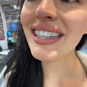 Iced Out Diamond Gap Filler Cap — Handmade Custom Personalised Fit Grillz in Sterling Silver or Gold | Any Teeth! Free Mould Kit Included!