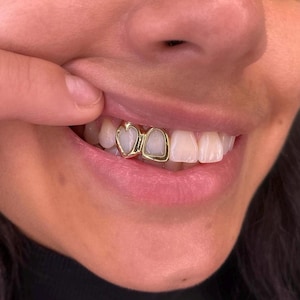 Heart & Open Face Window Cap — Handmade Custom Personalised Fit Grillz in Sterling Silver or Gold | Any Teeth! Free Mould Kit Included!
