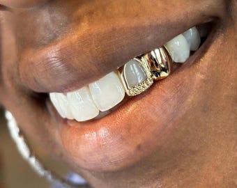 Plain & Open Face Window Iced Out Diamond Tip — Handmade Custom Fit Grillz in Sterling Silver or Gold | Any Teeth! Free Mould Kit Included!
