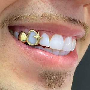 Sternform Fenster & Schlichte Kappe - Handgemachte benutzerdefinierte personalisierte Fit Grillz in Sterling Silber oder Gold | Alle Zähne! Freies Mold Kit inklusive!