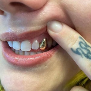 Casquettes unies dorées — Grillz fait main sur mesure en Dental Gold | Toutes les dents ! Kit de moule gratuit inclus !