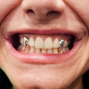 Casquettes style vampire Crocs K9 — Grillz personnalisées faites à la main en argent sterling ou en or | Toutes les dents ! Kit de moule gratuit inclus !