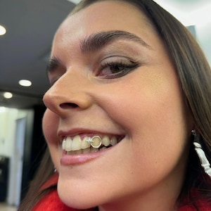 Open Face Window Mini Star Cap — Handmade Custom Personalised Fit Grillz in Sterling Silver or Gold | Any Teeth! Free Mould Kit Included!