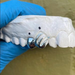 Tiger Scratch Style Cap — Handmade Custom Personalised Fit Grillz in Sterling Silver or Gold | Any Teeth! Free Mould Kit Included!