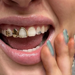 Window + Plain Cap In Dental Gold & Sterling Silver Custom Made Grillz Any Teeth FREE Shipping! Free Mould Kit Included!