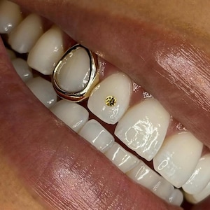Open Face Window Cap — Handmade Custom Personalised Fit Grillz in Sterling Silver or Gold | Any Teeth! Free Mould Kit Included!