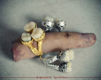 1 Grande bague "tri dents" à (fausses) molaires humaines sur support or antique, tribal, gothique, glauque et creepy