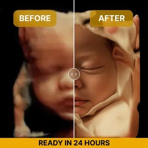 Ultraschall zu Babyfoto | Realistisches Portrait von 3D 4D 5D Scan | Schwangerschaft-Andenken