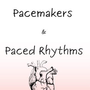 以下が含まれることがあります： 「Pacemakers & Paced Rhythms」の文字が黒い筆記体で書かれた医療をテーマにしたグラフィック。テキストの下には、柔らかなピンクのグラデーションの背景に、人間の心臓の詳細な白黒イラストが描かれています。