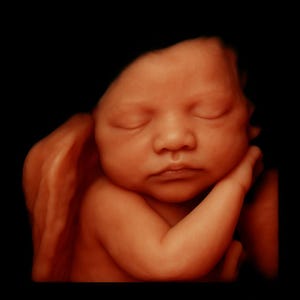 Ultrasaound 8k baby image 3d 4d 5d 8d Real View Baby AI Photo Transformation Ultrasound Scan, First Baby Photo