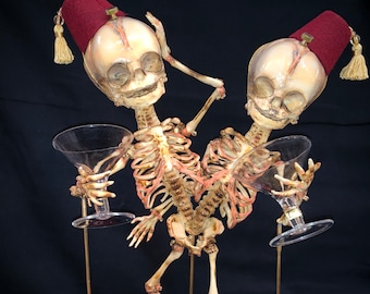 SALE Conjoined Twins Siamese Fetal Skeletons