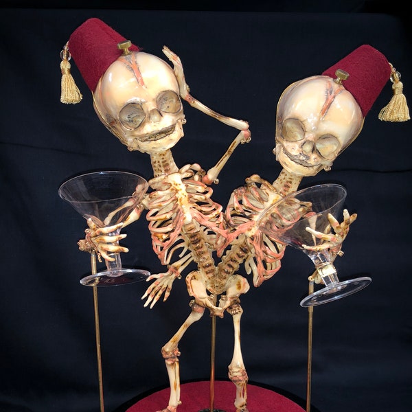 SALE Conjoined Twins Siamese Fetal Skeletons