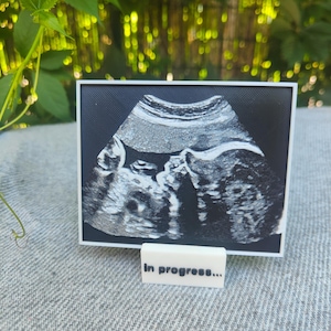 Peut inclure: Une image d'échographie encadrée en noir et blanc, représentant un bébé. Le cadre est blanc avec un fond noir texturé. Un petit bloc blanc avec le texte "In progress..." est devant le cadre.