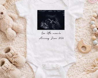 Personalized Ultrasound Onesie | Custom Sonogram Pregnancy Announcement