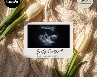 May include: A pregnancy announcement card featuring a sonogram image of a baby. The card is white with the text "Baby Porter" and "Due November, 20YY". The card is surrounded by cream-colored tulips and a knitted blanket.