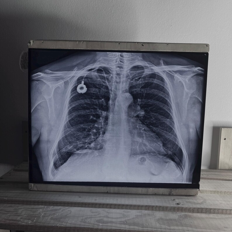 Authentic Retro X-ray Radiography Films – 14x17 Inch - Etsy