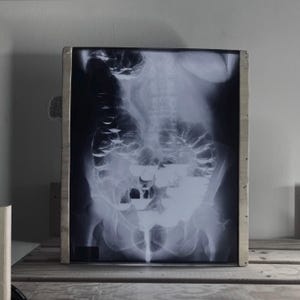 Könnte beinhalten: Röntgenbild eines menschlichen Torsos, gerahmt in einem hellfarbigen Holzrahmen. Das Graustufenbild zeigt das Skelett und die inneren Organe, einschließlich Wirbelsäule und Darm. Das Bild wird auf einer Holzoberfläche angezeigt.
