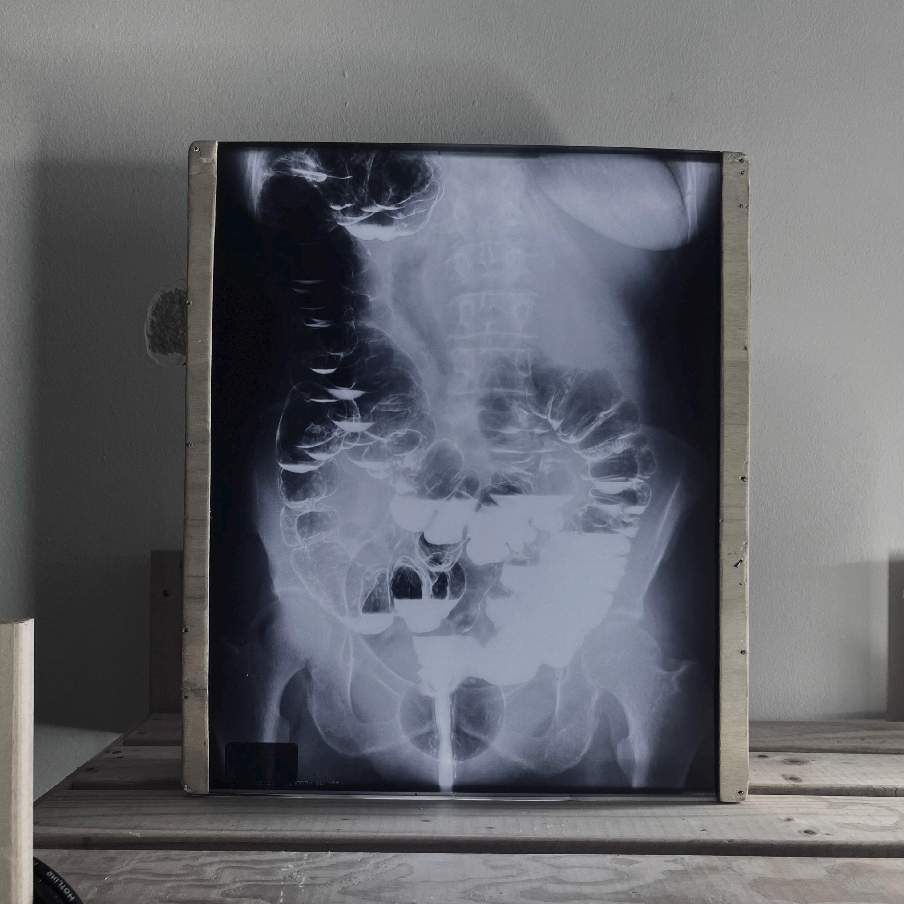 X-RAY 9CD＋DVD limited X-RAY 9CD＋DVD limited | eBay