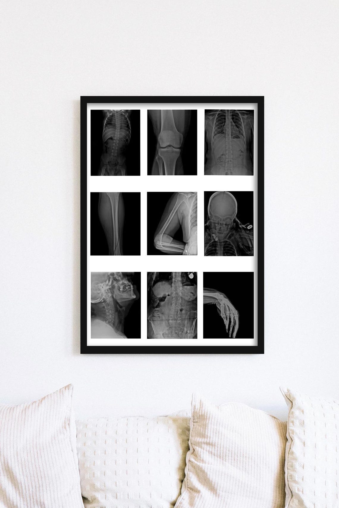 Skeleton X-ray Printable Art | Digital Collage of Radiology Samples ...