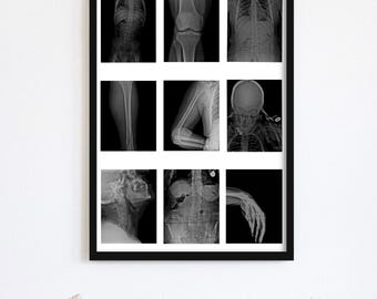 Arte imprimible de rayos X de esqueleto / Collage digital de muestras de radiología / Descarga instantánea
