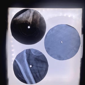 May include: Three circular X-ray films arranged on a square light box. Two films display grayscale skeletal structures, including a long bone and joint anatomy, while the third film is a solid, translucent blue-toned circle with a central hole.