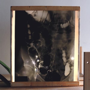 Könnte beinhalten: Ein beleuchtetes medizinisches Röntgenbild des menschlichen Bauches, eingefasst in einem Holzrahmen. Das Bild zeigt das Skelett und die inneren Organe in Grau- und Schwarztönen, mit warmem Licht von hinten.