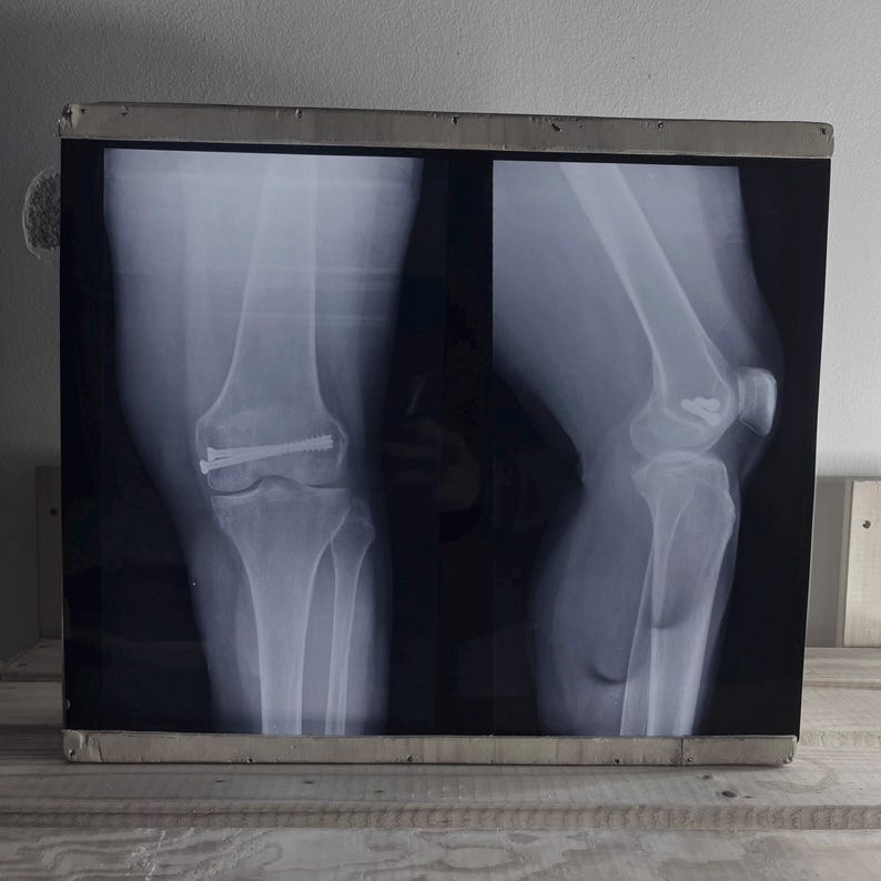 Authentic Retro X-ray Radiography Films – 14x17 Inch - Etsy