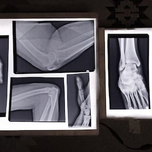 Puede incluir: Imágenes de rayos X médicas de anatomía humana, incluyendo una mano, codo, rodilla, tobillo, pie y dedo. Las imágenes se muestran en cajas de luz iluminadas, mostrando la estructura esquelética en detalle. Las imágenes son en escala de grises.