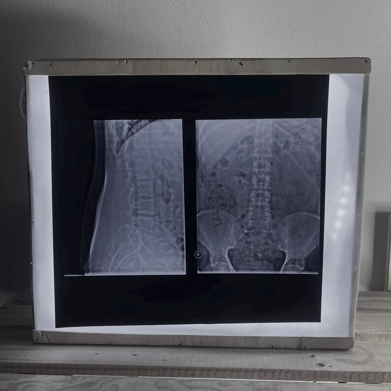 Authentic Retro X-ray Radiography Films – 14x17 Inch - Etsy