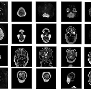 Unique MRI Art | Frames + Videos | Anonymized Stock Samples for Study & Medical Art Collectors