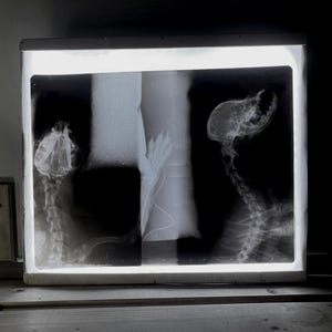 Rare Vet Vintage X-Ray Films - 14x17 inches