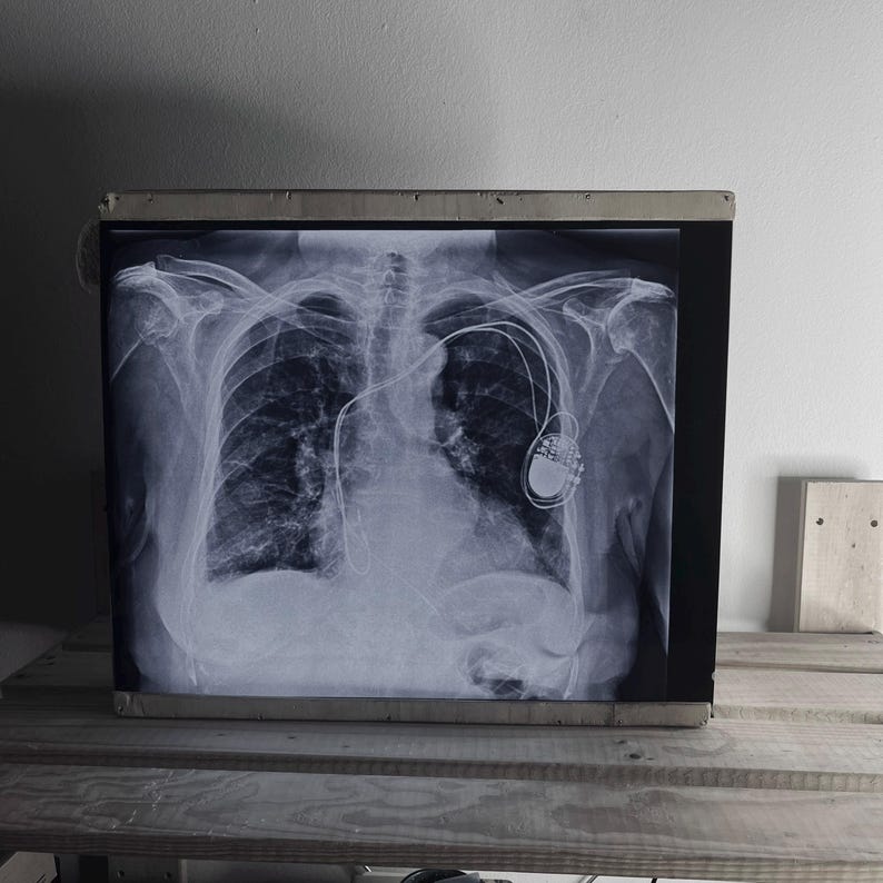 Authentic Retro X-ray Radiography Films – 14x17 Inch - Etsy