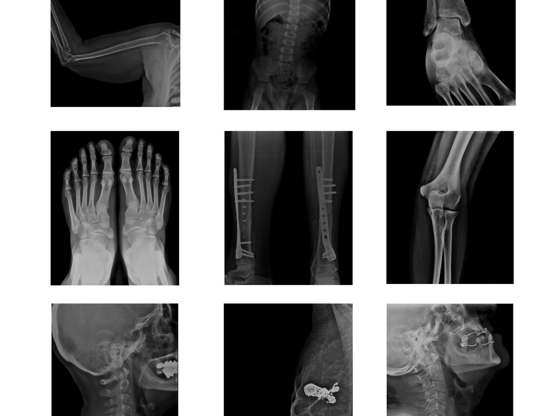 Radiology X-ray Samples - 109 Images & 1 Video - Etsy