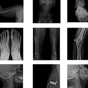 Radiology Samples  - 109 Images & 1 Video