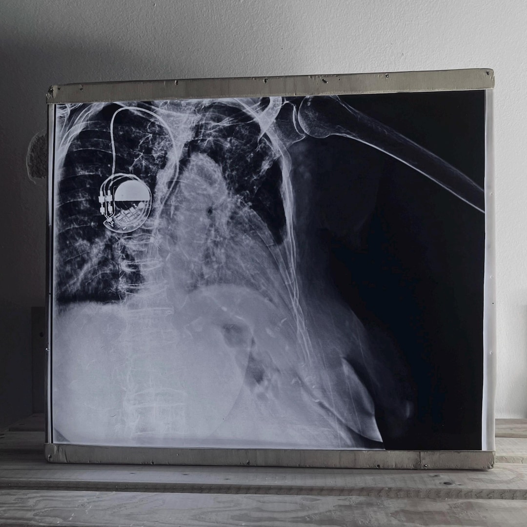 Vintage Radiography X-ray Original Films – Large 14x17 Format - Etsy