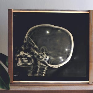 Könnte beinhalten: Ein gerahmtes Kunstwerk mit einer durchscheinenden Röntgenaufnahme eines menschlichen Schädels. Der Schädel ist vor einem schwarzen Hintergrund platziert und in einem Holzrahmen eingefasst. Das Kunstwerk wird auf einer Holzoberfläche in der Nähe einer Topfpflanze ausgestellt.