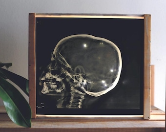 Radiography Vintage X-Ray Films - 10x12 inches