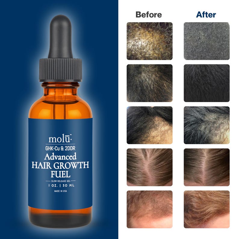 May include: A brown glass bottle with a black dropper, labeled "MOLU ADVANCED HAIR GROWTH FUEL." The label is dark blue with white text. The image includes before-and-after photos of hair growth. The bottle contains 1 oz. / 30 ml.