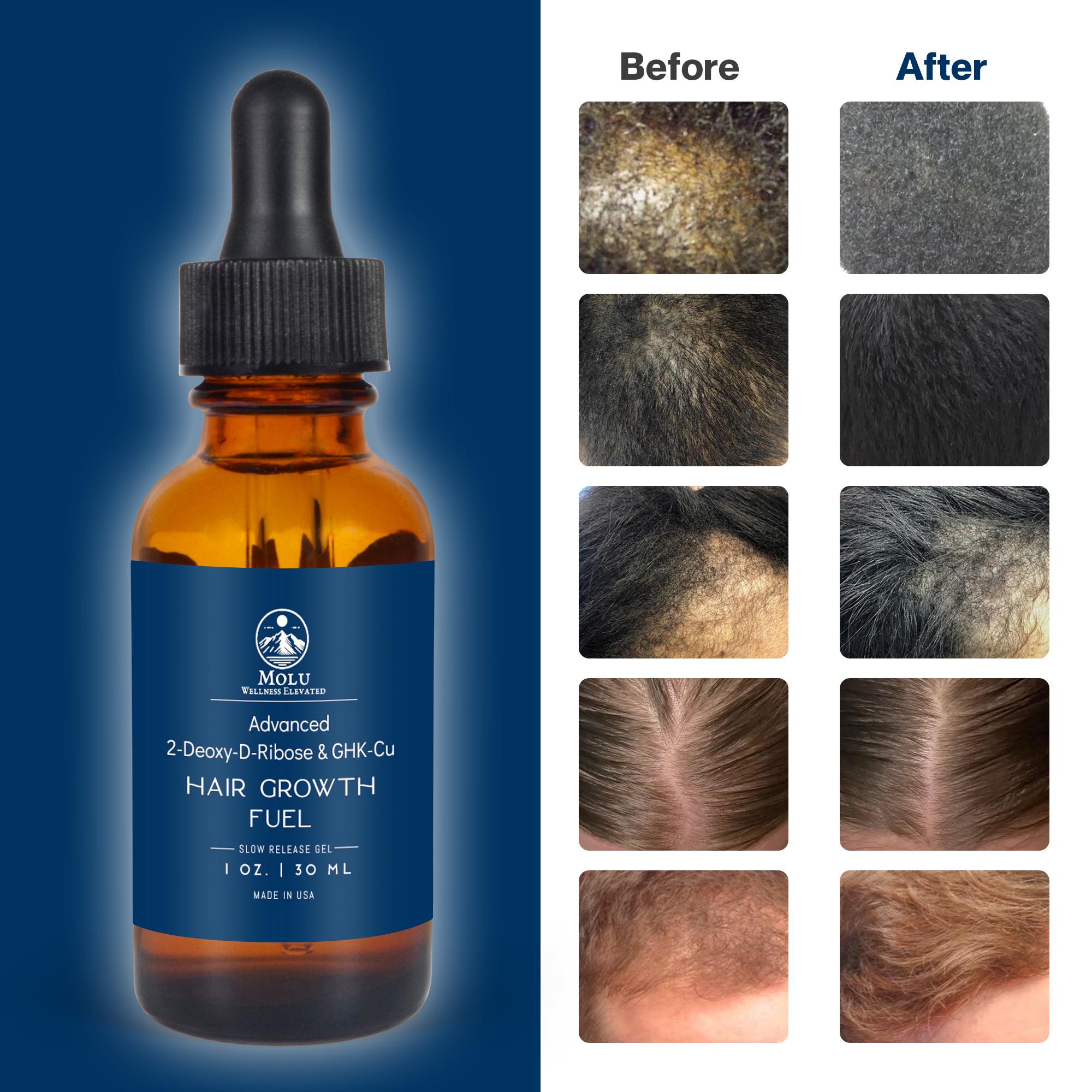 Ghkcu Peptide Hair Growth Serum, 2-deoxy D-ribose, Ghkcu, DHT Blocker,  Korean Ginseng, Caffeine Hair Growth Formula - Etsy Ireland