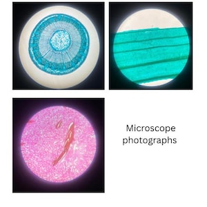 Può includere: Fotografie al microscopio di campioni biologici. Un'immagine mostra una sezione trasversale con anelli concentrici blu e bianchi. Un'altra mostra linee parallele verdi. Una terza immagine è rosa con una forma rossa.
