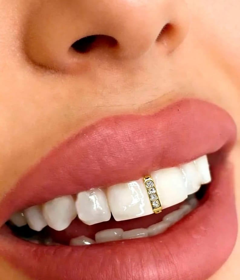 May include: A gold-toned tooth gem or grillz accessory featuring a vertical bar design set with three small, clear, round-cut stones. The piece is securely attached to the center of a single upper front tooth, positioned between the two central incisors.