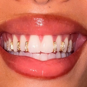 May include: A set of gold tooth grills featuring small, clear, sparkling stones embedded in vertical channels. The jewelry is fitted onto individual teeth, creating a decorative accent across the upper row of teeth, visible against the lips.