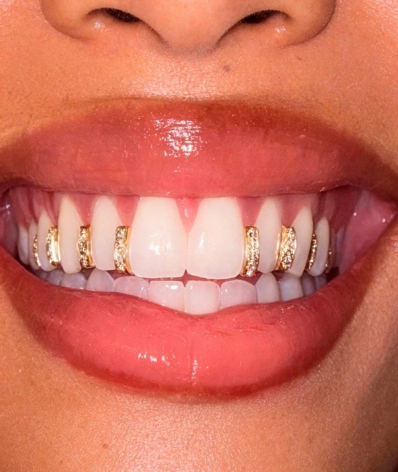 May include: A set of gold tooth grills featuring small, clear, sparkling stones embedded in vertical channels. The jewelry is fitted onto individual teeth, creating a decorative accent across the upper row of teeth, visible against the lips.