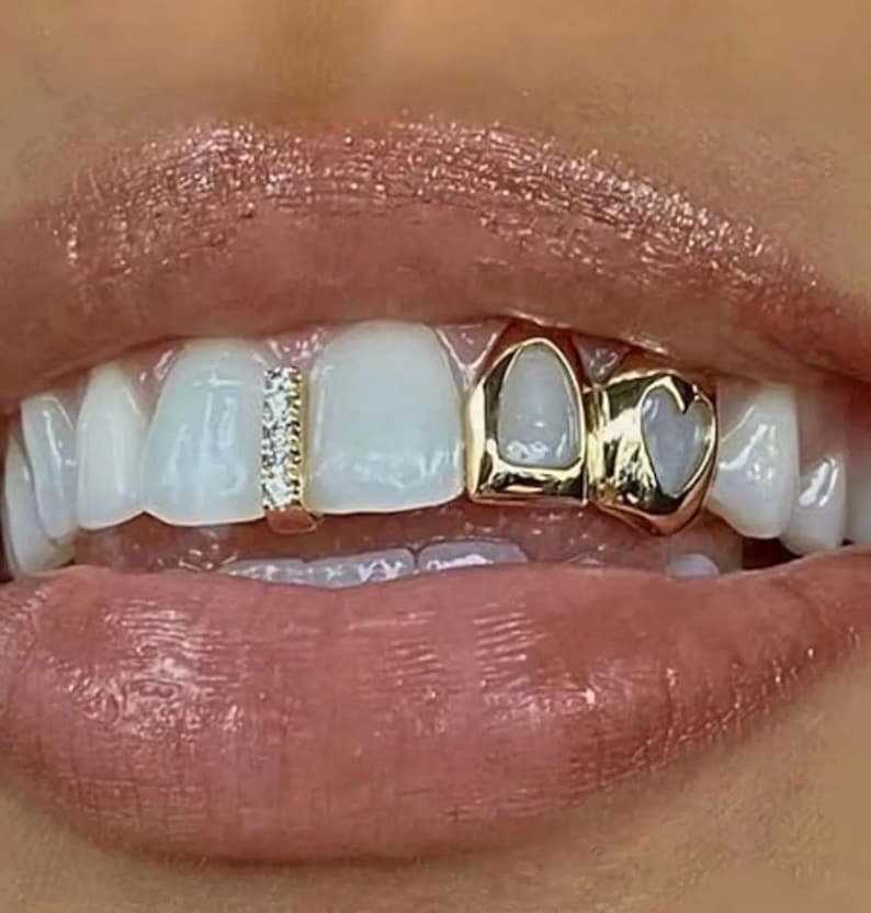 May include: A gold tooth grill set featuring a vertical bar with small clear stones on one tooth and a gold cap with a heart-shaped cutout on the adjacent tooth. The dental jewelry is positioned on the upper teeth, contrasting with the natural white enamel.